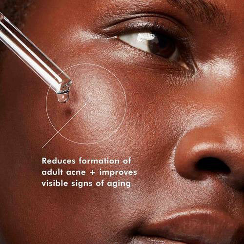 A 30ml brown glass dropper bottle labeled “SKINCEUTICALS - BLEMISH AGE DEFENSE” by SKIN CEUTICALS, a salicylic acid serum formulated to treat acne and aging skin prone to breakouts.