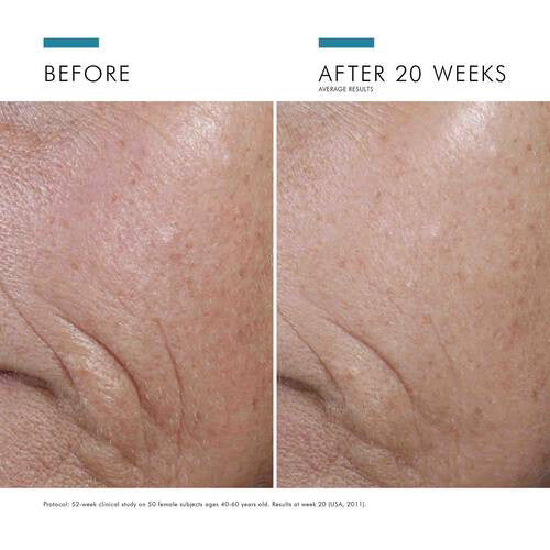 A 30 ml (1 fl oz) brown glass dropper bottle labeled "SKINCEUTICALS - CE FERULIC" by SKIN CEUTICALS, with blue and white text and a black dropper cap, contains a vitamin C serum providing antioxidant protection.